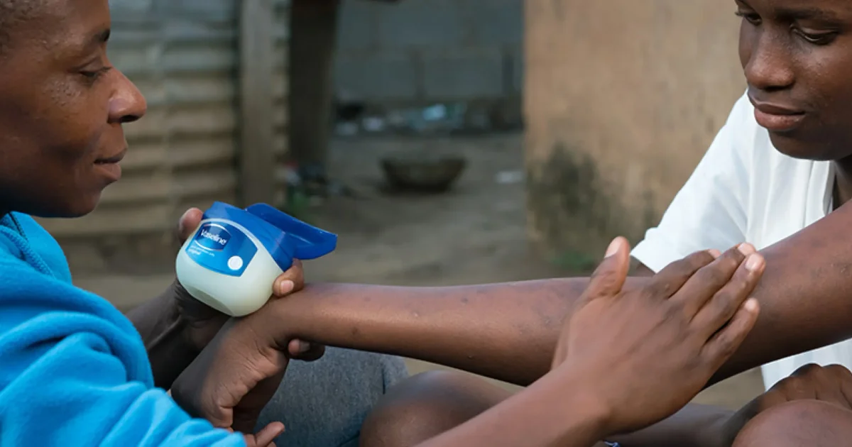 Ogilvy's 'Vaseline Verified' Campaign Wins Four Grand Prix at Spikes Asia